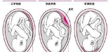 揭秘胎盘（探究胎盘的构造及其重要作用）