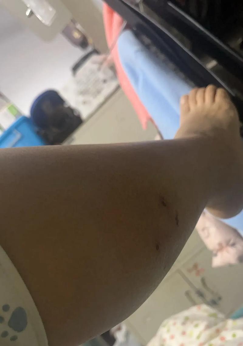 猫鼬被毒蛇咬伤的紧急救治（探索治愈猫鼬毒蛇咬伤的有效方法）
